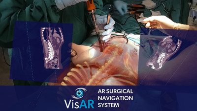 VisAR, an augmented reality surgical navigation system from Novarad, receives FDA approval for interoperative stereotactic spinal surgical guidance.